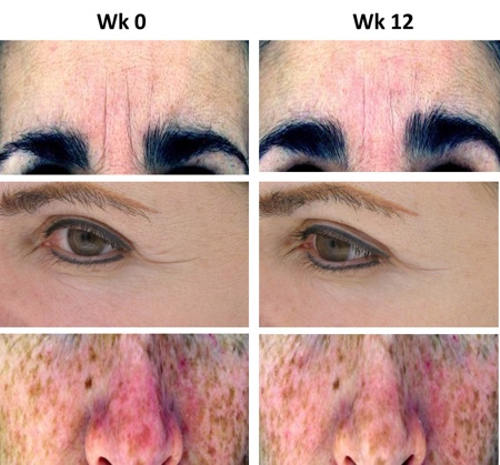Figure 4: Before and after