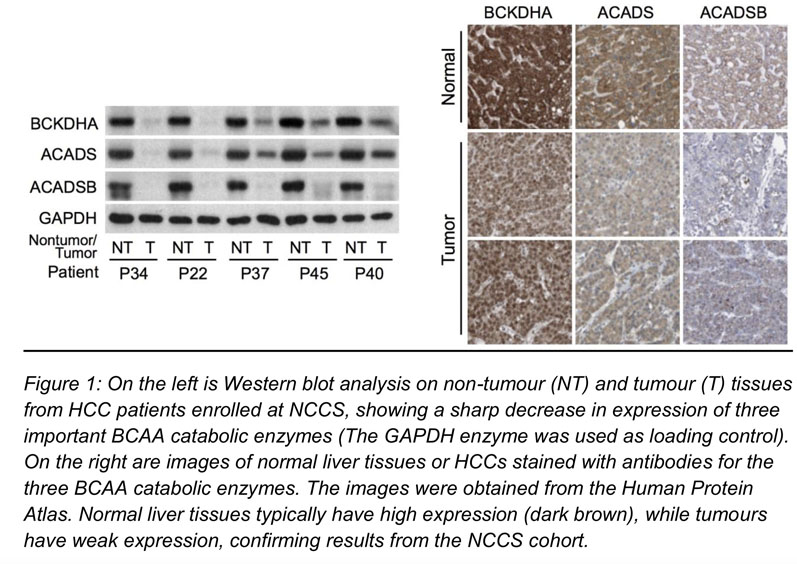 Branched-chain amino acids found to regulate the development and progression of cancer