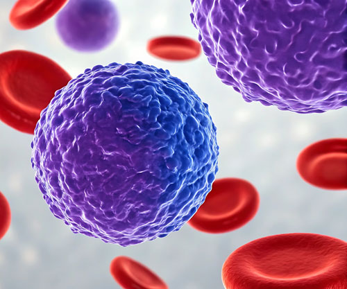 Natural compound could fight aggressive leukaemia and amplify the effect of chemotherapy drugs
