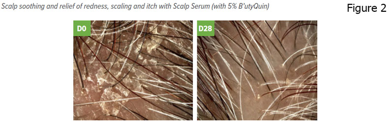The many healthy ageing benefits of black seed oil